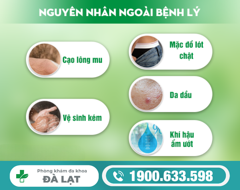 Hình ảnh minh họa